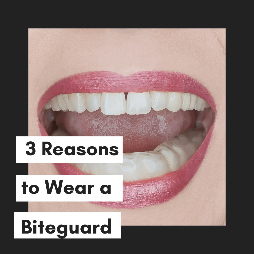 3 Reasons to Wear a Biteguard Southwest Family DentistryDentist in Lake City, FL John A