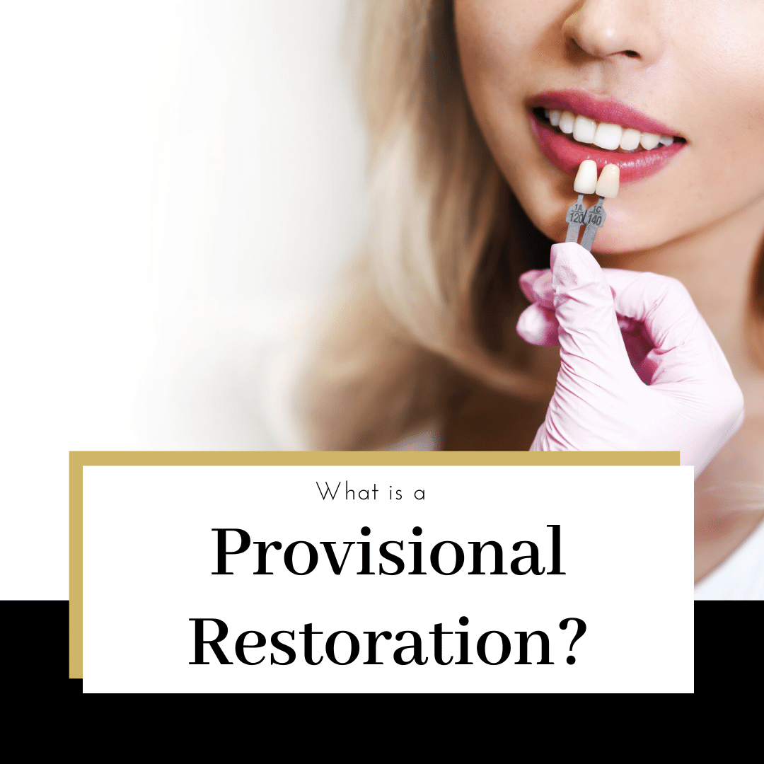 what-is-a-provisional-restoration